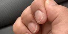 تعبیر خواب کنده شدن ناخن امام صادق و ابن سیرین + دست و پا برای زنان و دختران تعبیر خواب کنده شدن ناخن امام صادق و ابن سیرین + دست و پا برای زنان و دختران