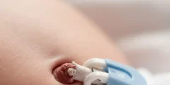 تعبیر خواب ناف نوزاد امام صادق و ابن سیرین + افتادن بند ناف نوزاد دختر و پسر